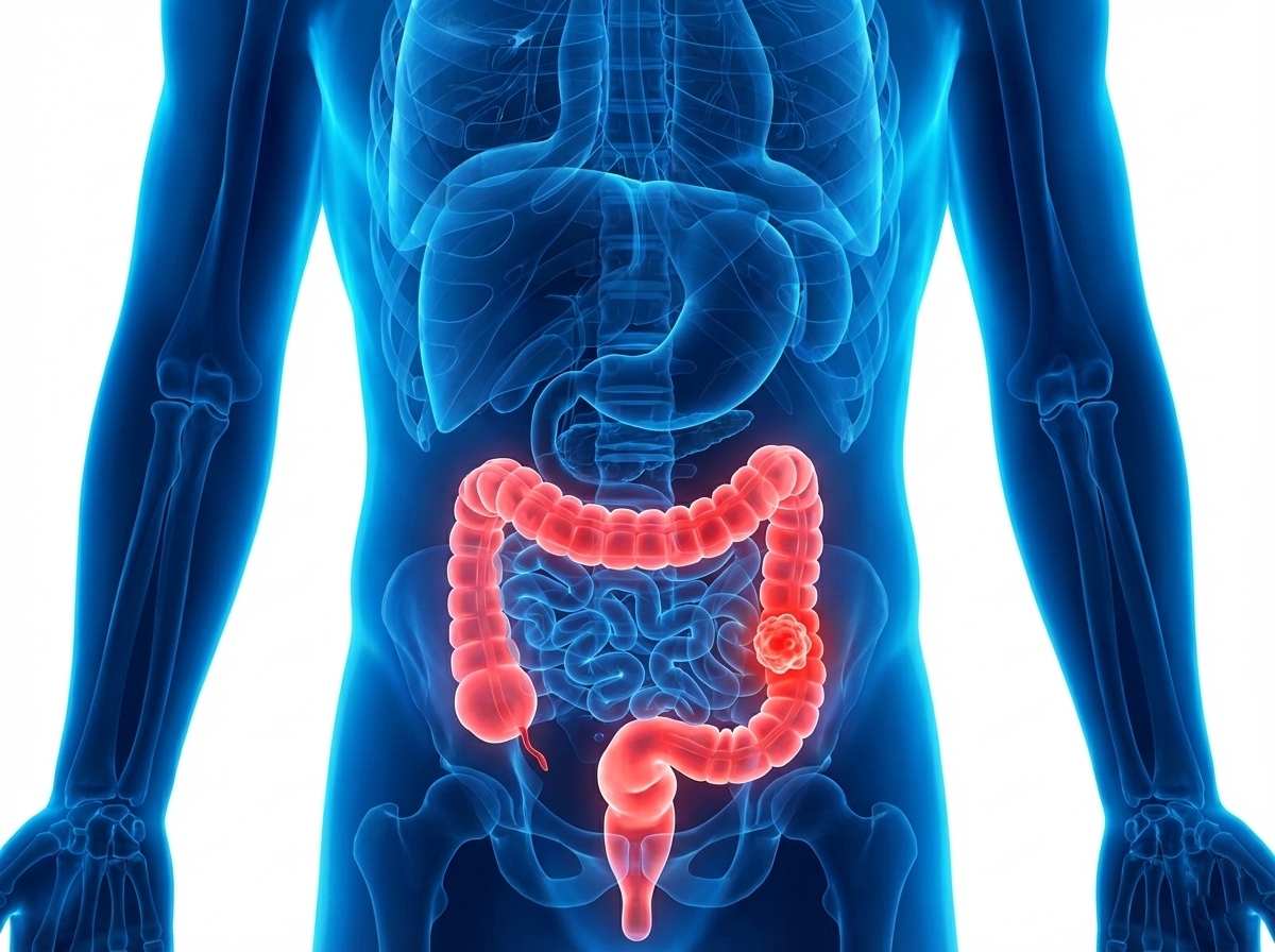 Screening carcinoma del colon retto